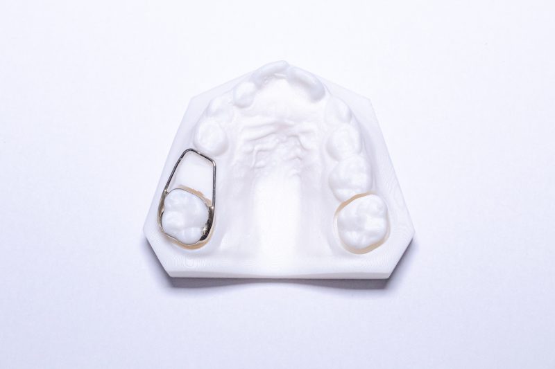 Fixed Appliances Perfect Finish Ortho Lab Inc.